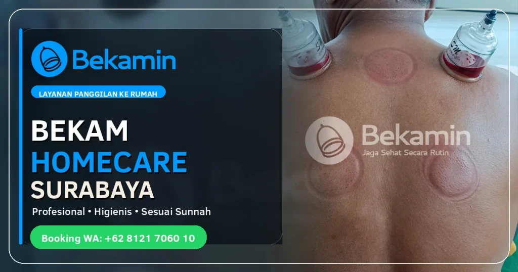 bekam homecare surabaya